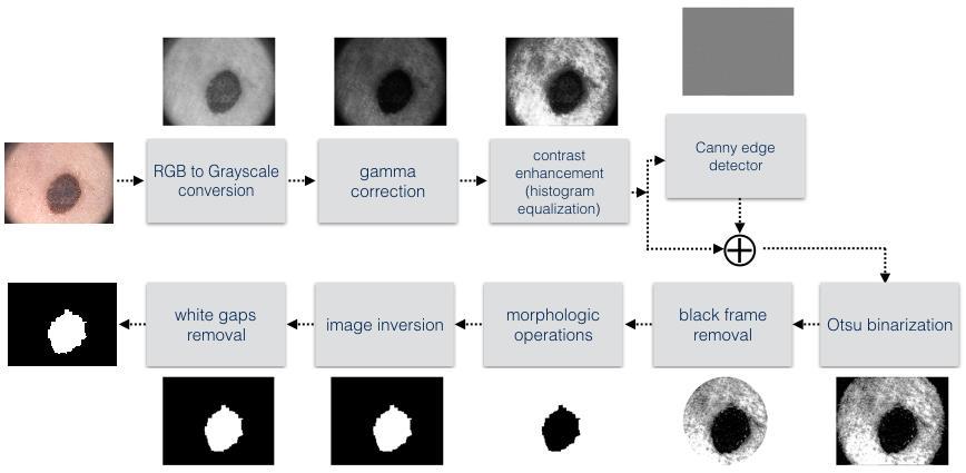 Within this following steps have been used: RGB to grayscale conversion, gamma correction, contrast enhancement using histogram equalization technique, Canny edge detector added to image to enhance