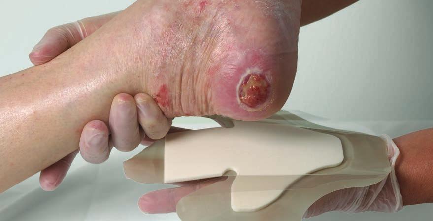 Biatain Ag Adhesive Heel i Sacral Opatrunki piankowe ze srebrem.
