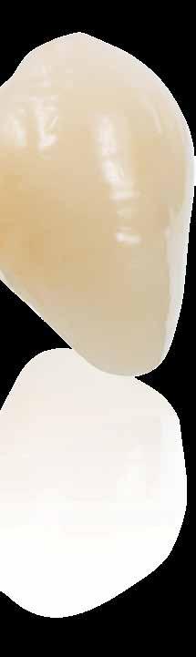 IPS e.max CAD IPS e.max CAD dwu krzemian litu jest najczęściej stosowanym materiałem szklano ceramicznym na świecie.* Materiał ten obejmuje szeroki zakres wskazań i łączy wydajność z łatwością pracy.
