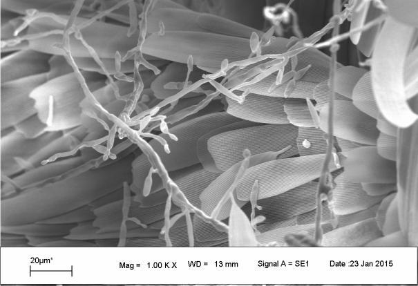 different position and coated with gold in sputter coater (POLARON SC7620) and were examined in LEO 1430VP scanning electron microscope (Zeiss).