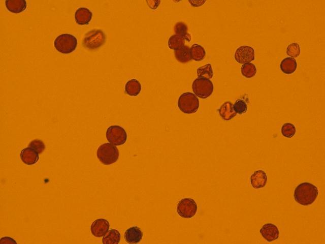 Ziemniak Polski 2011 nr 1 1 Hodowla i genetyka OCENY CYTOLOGICZNE STOSOWANE W PRACACH HODOWLANO- -GENETYCZNYCH NAD ZIEMNIAKIEM mgr Iwona Wasilewicz-Flis IHAR PIB, Zakład Genetyki i Materiałów