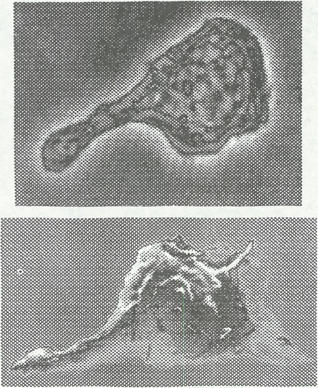 Rekonstrukcje te wykonano na podstawie zdjęć publikowanych w Living Blood Cells and Their U ltrastructure, Marcel Bessis Już Lewis (1931) zaobserwował, że