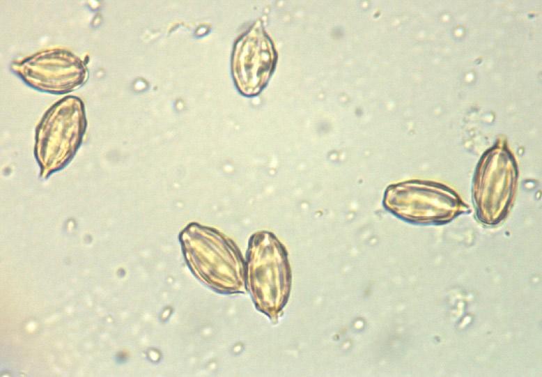 Fot. 2. Zarodniki (fot. T. Ślusarczyk). Photo 2. Spores (photo by T. Ślusarczyk). Gautieria otthii Trog 1857 Synonim:G. pallida Harkn. (= G. mexicana (Fischer) Zeller & Dodge 1934 ss. auct. eur.