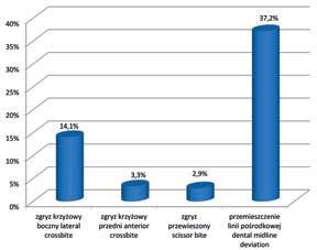 Distribution of transverse discrepancies in the examined population. lewej w 10,3 proc. W badaniu klinicznym stwierdzono, że po stronie prawej u 63,2 proc.