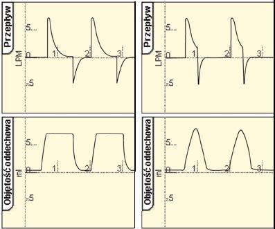 Funkcja ta jest zupełnie która jest zupełnie nowym sposobem umożliwiającym zarządzanie objętością oddechową pacjenta.