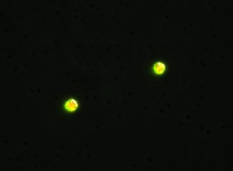 % of adhered cells Adhezja i ruchliwość monocytów w obecności