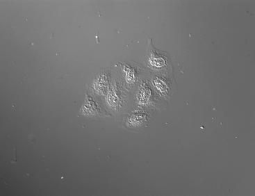 Przejście epitelialno-mezenchymalne Epithelial-Mesenchymal Transition (EMT) Radisky, D. C. J Cell Sci 2005;118:4325-4326 1.