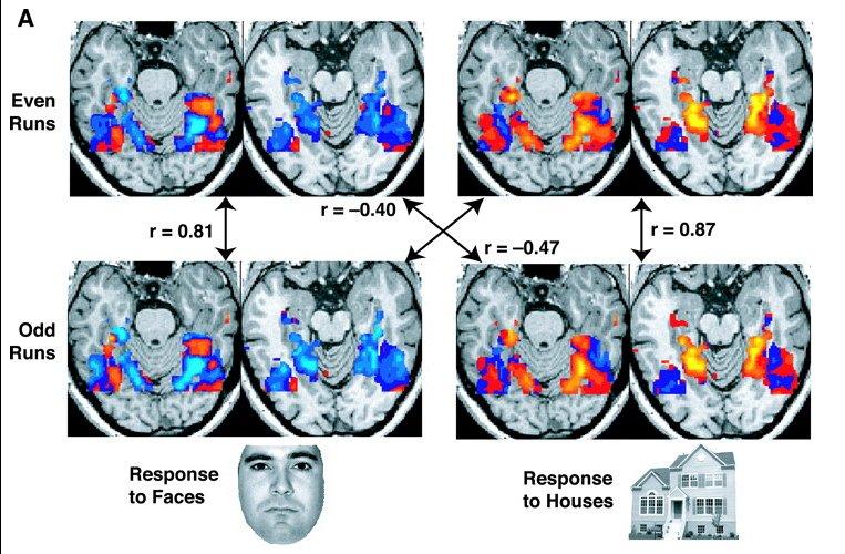 Magnetyczny Rezonans Jądrowy Funkcjonalne obrazowanie RM fmri Czułość i rozdzielczość urządzeń jest tak duża, że umożliwia śledzenie zmian (np.