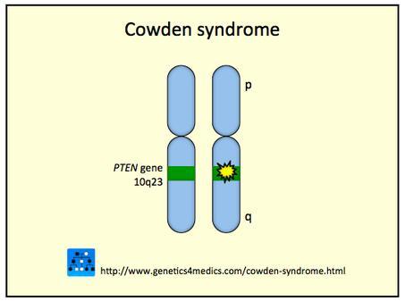 Zespół Cowdena - rodzinnie występujący zespół genetyczny predysponujący do rozwoju wielu nowotworów, w tym raka endometrium - przyczyna mutacja