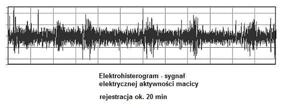 7--3 Lieraura. Zielińsi.P. Cyfrowe przewarzanie sygnałów, WKiŁ 5. Ozime E. Podsawy eoreyczne analizy widmowe sygnałów, PWN, 985 3. Lyons R.G. Wprowadzenie do cyfrowego przewarzania sygnałów, WKiŁ 4.