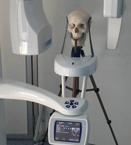 Model czaszki z wydłużonymi wyrostkami rylcowatymi przy użyciu plasteliny. Fig. 2. Positioning of the skull model.
