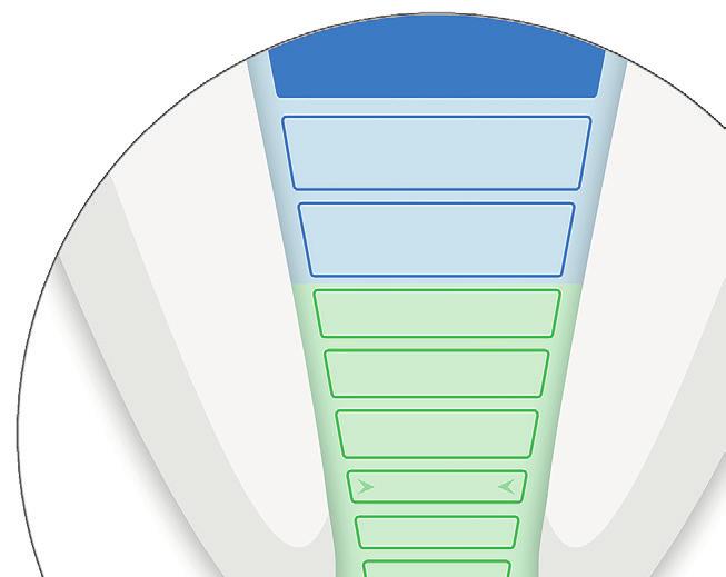 E Dostosowanie wizualizacji działania endometru IQ Przed przeprowadzeniem zabiegu zawsze należy wykonać test na obiegu zamkniętym. (patrz rozdział 3).