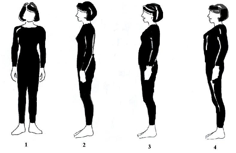 Rys. Postawa prawidłowa wadliwa Postawa: prawidłowa: 1,2 ( stojąca, wyprostowana, wyrażająca aktywność, lekki rozkrok, rozluźnione mięśnie tułowia i szyi),