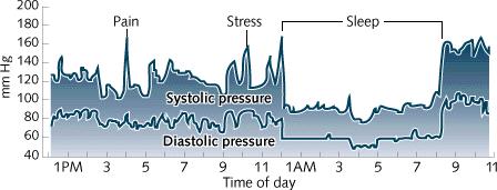 Czym jest ciśnienie tętnicze? Pomiar RR w czasie doby.