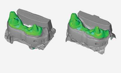 PROFESJONALNA PRODUKCJA Formlabs opracował zbiór standardowych i biokompatybilnych żywic służących do specyficznych zastosowań dentystycznych oraz dopasowanych specjalnie, aby sprostać wymaganiom w