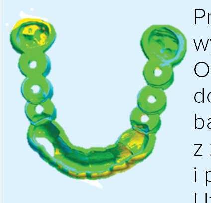 Wykorzystaj zalety, jakie oferuje implantologia cyfrowa, aby skrócić czas spędzony przez pacjenta na fotelu, zwiększyć jego komfort oraz uzyskać łatwe i wysoce precyzyjne umiejscowienie implantu.