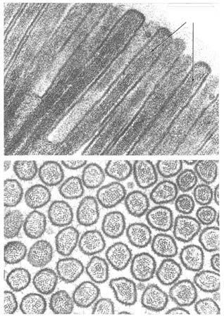 mikrofilamentów cienkich (aktynowych) Długość 0,5 2 µm