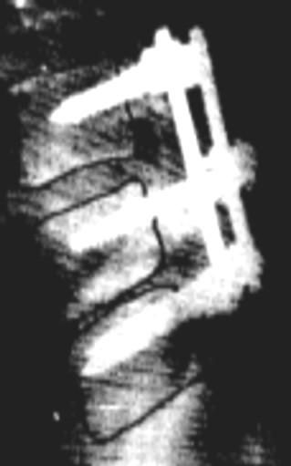 Wymagania metody dotyczące kształtów elementów skończonych narzuciły nieznaczne uproszczenia geometrii analizowanego układu (rys.2).