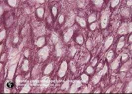 Chondrocyty położone są w jamkach, gdzie