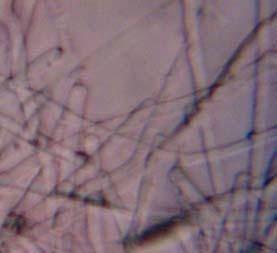 8 G. Szczepaniak i in. YM LB SG Fot. 3. Mikroskopowy obraz adhezji komórek drożdży G.