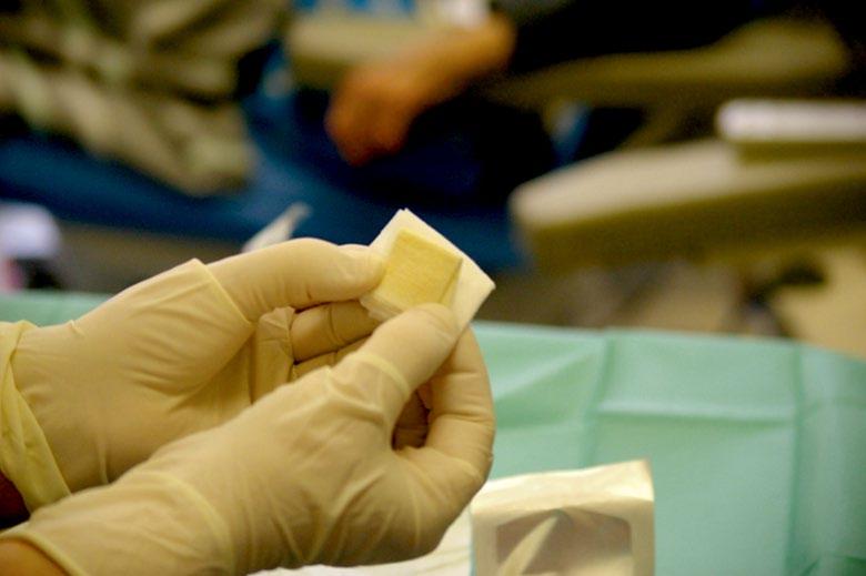 zachowanie stabilnej żelowej konsystencji przez długi czascc vvwoundclot jest dostępny również w Polsce (LockPharma sp. z o.o.) cc w produkcie i przeniesienie ich bezpośrednio na naczynie, a następnie do krwioobiegu, skracając w ten sposób czas tworzenia się skrzepu i wzmacniając utworzony skrzep.