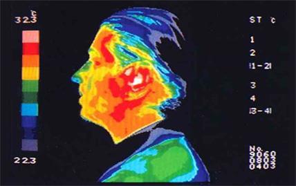 Przyszłośd Modele trójwymiarowe Wykorzystanie dwóch kamer Mapy głębokościowe Algorytmy rekonstrukcji 2D do 3D Informacja z sekwencji obrazów Analiza twarzy w podczerwieni (brak