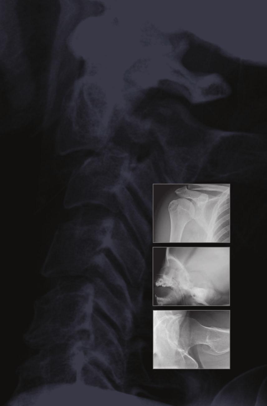 Diagnostyka obrazowa w traumatologii A SURVIVAL GUIDE N. Raby, L. Berman, S.