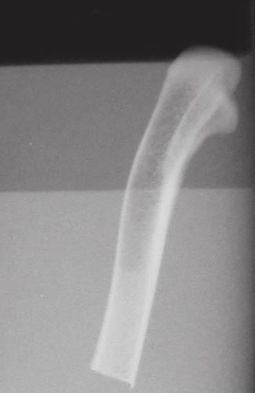 Podstawowe zasady Podstawy radiografii Obraz radiograficzny Tkanki będące na drodze wiązki promieniowania rentgenowskiego pochłaniają je (tj. osłabiają) w różnym stopniu.