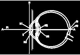 org) A-A S F1 F2 H H1 H2 H3 H4 N Axis of the eye Cornea vertex Anterior focal point Posterior focal point Principal plane of the corneal system Anterior principal point of