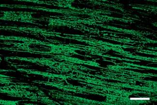 Dodatkowo, po zidentyfikowaniu fluorescencyjnego obiektu, istnieje możliwość automatycznego śledzenia go w czasie i przestrzeni, co jest niezbędne np.