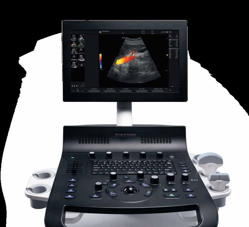 Kompletne rozwiązanie Versana Essential to kompletne rozwiązanie ultrasonograficzne to aparat, którt możesz nauczyć się używać szybko i wydajnie.