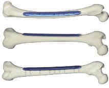 0ChLP FEMORAL SHAFT PLATE 7,0ChLP PLACA DEL EJE FEMORAL Len L R Len L R Non 2 132 3.7023.602 3.7022.602 4 174 3.7023.604 3.7022.604 6 216 3.7023.606 3.7022.606 8 258 3.7023.608 3.7022.608 2-16 132-426 Non 10 209 3.