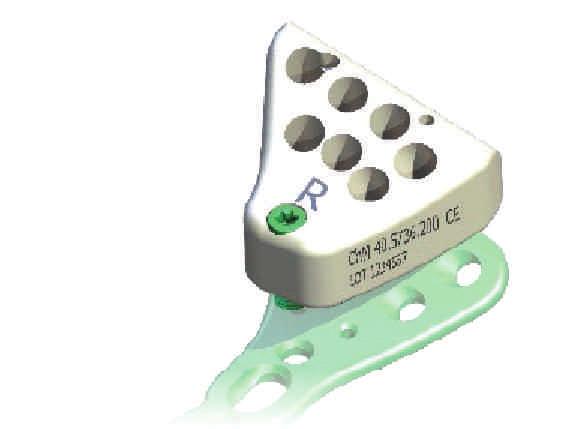 0ChLP implants - distal radius (with instruments) Поддон д/имплантатов 4,0ChLP-дистальная лучевая (c