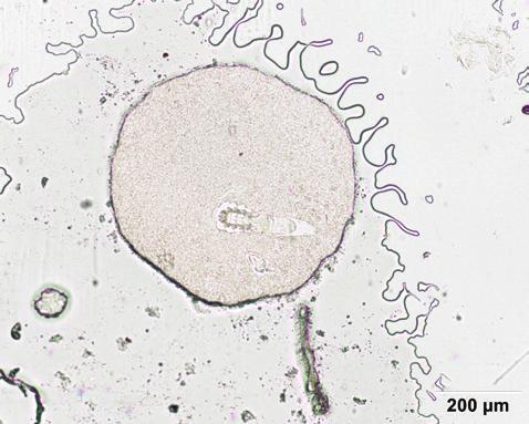 www.diagnostykalaboratoryjna.eu Rycina 1. Demodex brevis.