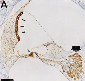 Ekspresja Kir w ślimaku Immunohistochemiczna lokalizacja Kir4.