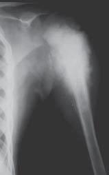 tissues, necrosis foci, location of the tumor relative to the neighboring vascular and nerve bundles.