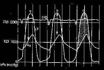 Radioizotope