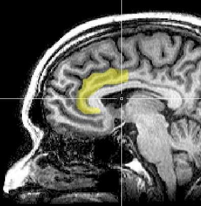 TRAUMA - MOTYWACJA - ZAKRĘT OBRĘCZY - DOPAMINA - APATIA WOLA ŻYCIA wycofanie z relacji zaniedbanie siebie utrata inicjatywy, brak decyzji brak kontroli nad