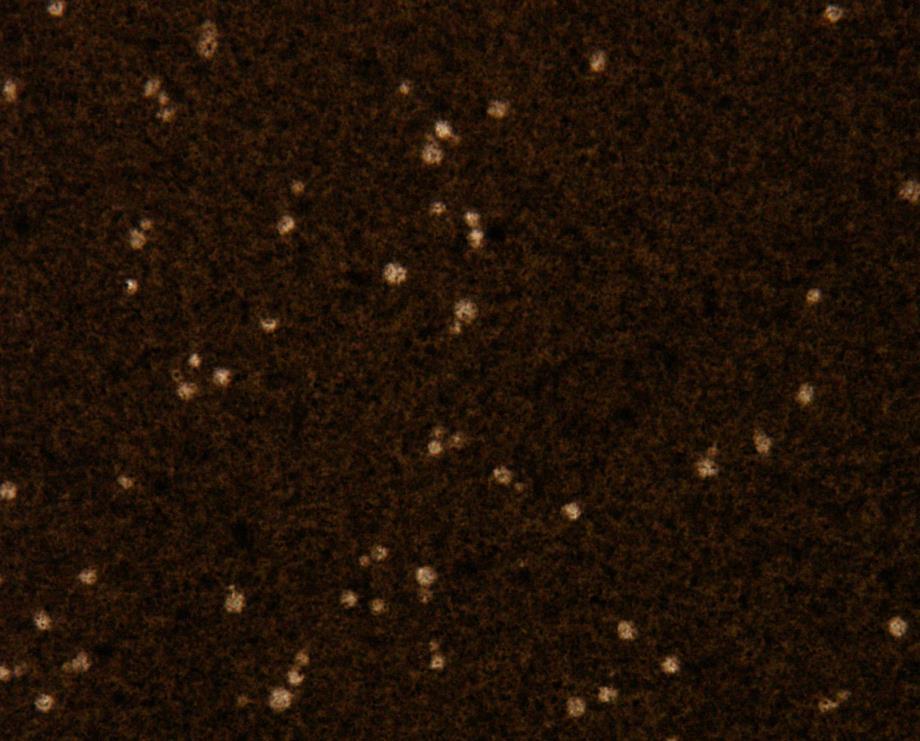 Zakażenia Cryptococcus neoformans Rezerwuarem C. neoformans jest przewód pokarmowy różnych ptaków, w Polsce przede wszystkim gołębi.