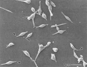 Mycoplasma pneumoniae Podstawowe informacje o chorobie : Typowe zakażenie rozwija się dość wolno a objawy choroby narastają stopniowo. Klinicznie zakażenie M.