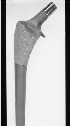 orthopaedic prostheses: Bioactivity,