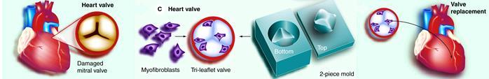 Heart valve
