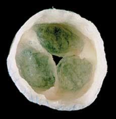 heart valve 