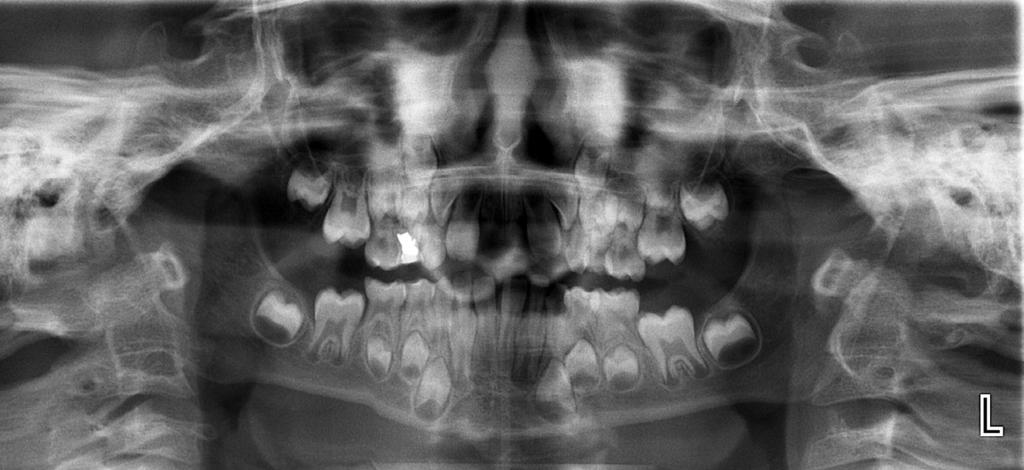 CLINICAL ORTHODONTICS 3/2018 fot. archiwum autorów 1 