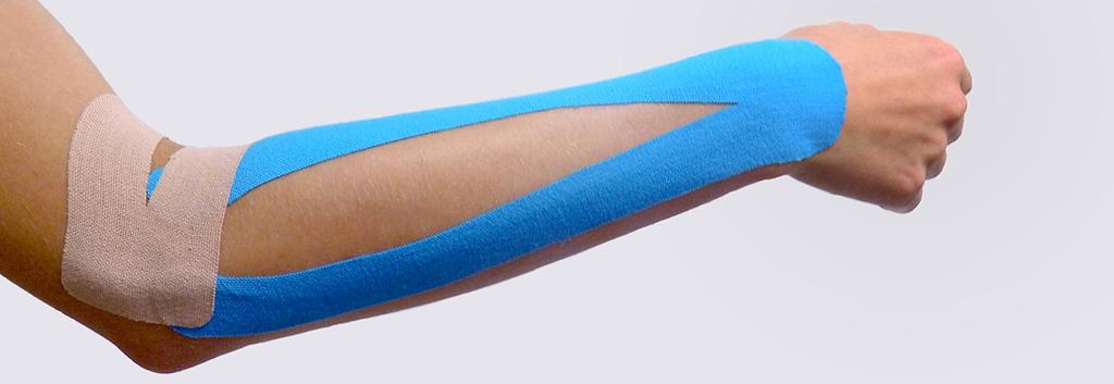 5a Fot. 5a. Mięśniowa aplikacja kinesiotaping 5b Fot. 5b. Mięśniowo-powięziowa aplikacja kinesiotaping etapach zwiększać siłę, wytrzymałość oraz elastyczność mięśni kończyny górnej.