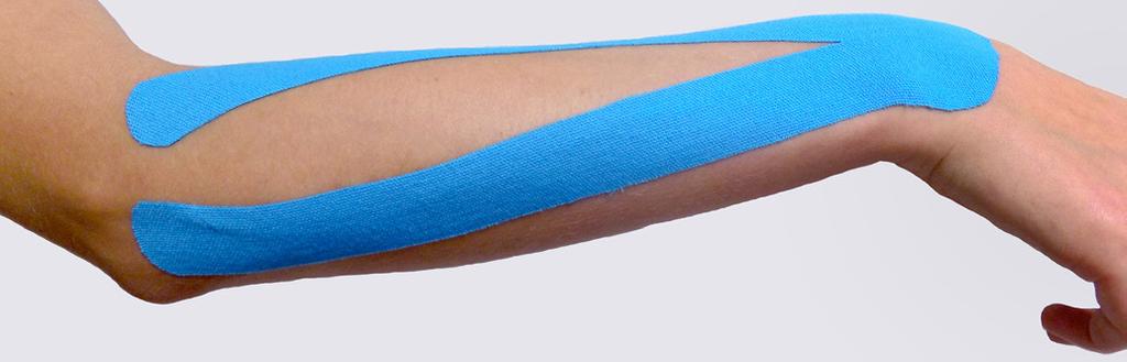 , Jull G. i wsp.: Mobilisation with movement and exercise, corticosteroid injection, or wait and see for tennis elbow: randomised trial. BMJ, 2006, 333 (7575), 939. 2. Terra B.B., Rodriguez L.M., Filho A.