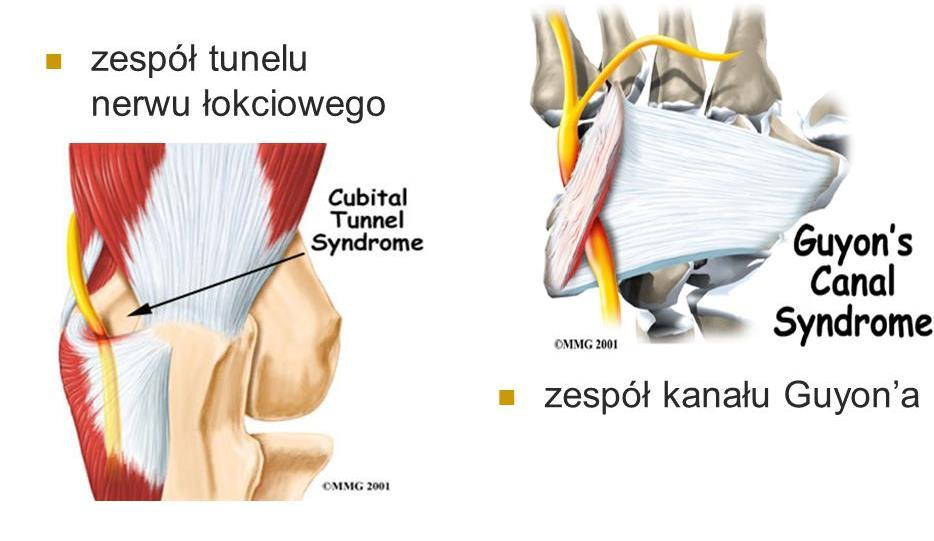 Nerw łokciowy: n.