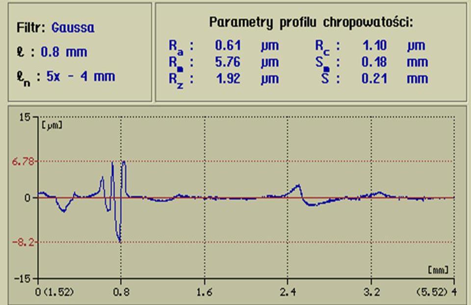 Implantacja p³yt AO wymaga rozleg³ego dostêpu operacyjnego, a to zwiêksza ryzyko infekcji i krwawienia œródoperacyjnego, powoduje traumatyzacje tkanek miêkkich i ich