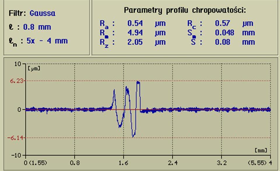 Przerwanie b¹dÿ czêœciowe uszkodzenie unaczynienia od miêœni i okostnej w miejscu osadzenia p³yty powoduje dalsze zaburzenia ukrwienia, co przy uszkodzonym ju kr¹ eniu