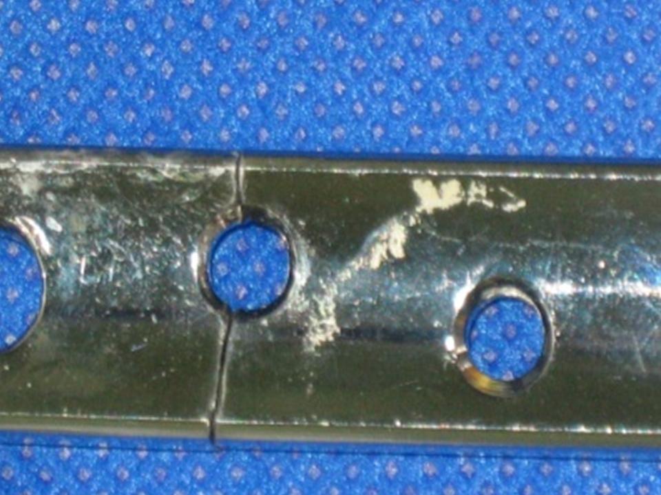 Rycina 13,14,15. Z³amania p³ytek AO. Fracture of AO plates. Rycina 16,17. Os³abienie przekroju przez otwory mocuj¹ce. Weakening of the crosssection coused by mounting holes.